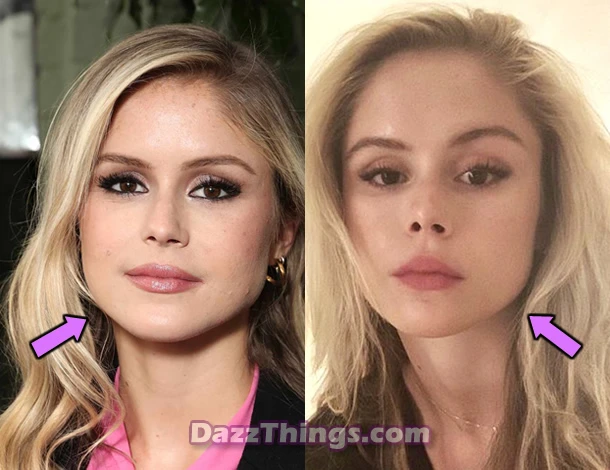 Erin Moriarty botox before and after comparison photo