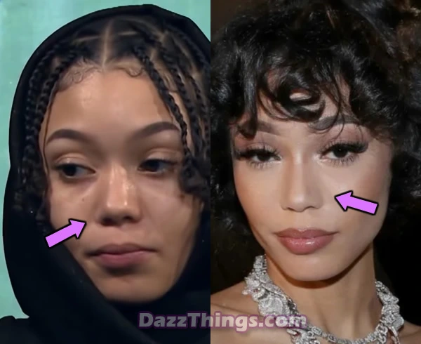 Coi Leray nose job before and after comparison photo