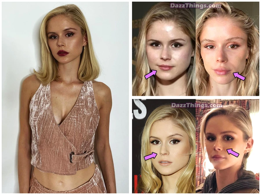 Erin Moriarty looks different because of plastic surgery?