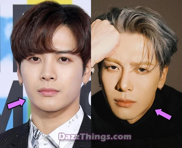 Jackson Wang botox before and after comparison photo