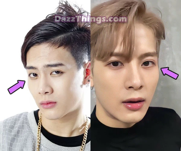 Jackson Wang eyelid surgery before and after comparison photo