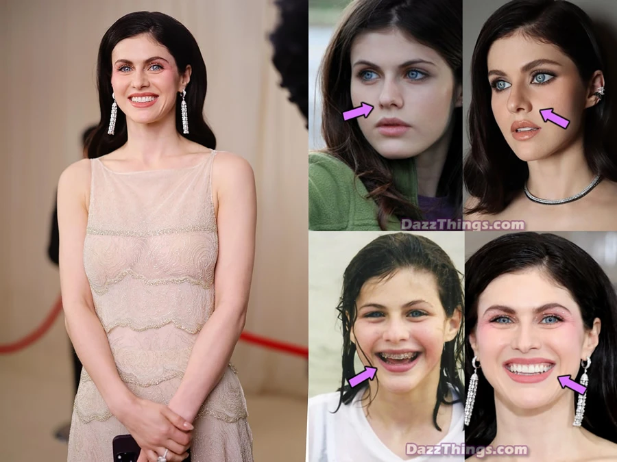 Alexandra Daddario Plastic Surgery Comparison Photos