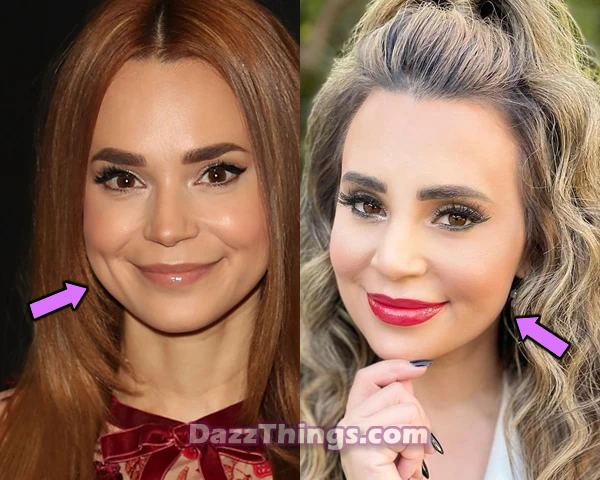 Rosanna Pansino botox before and after comparison photo