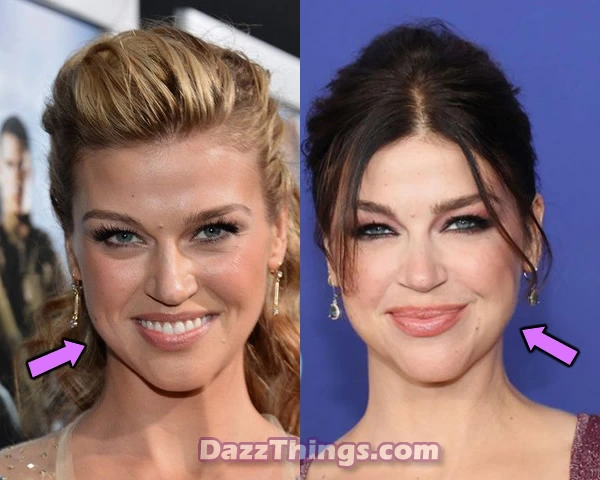 Adrianne Palicki botox before and after comparison photo