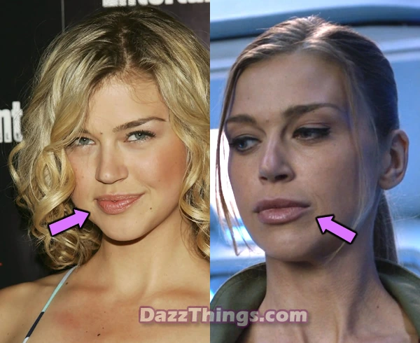 Adrianne Palicki lip injections before and after comparison photo