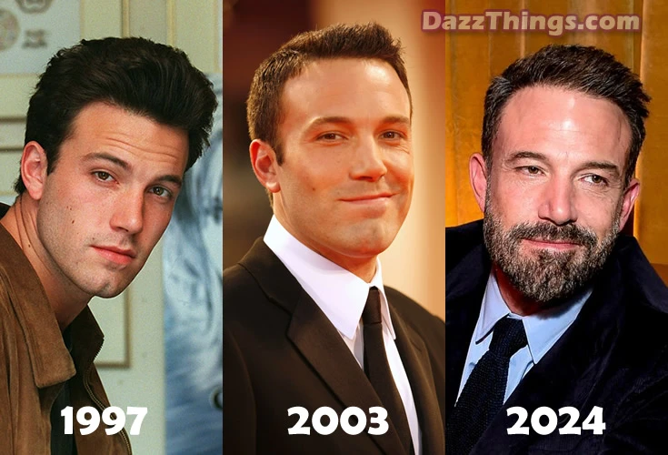 Ben Affleck receding hairline over the years