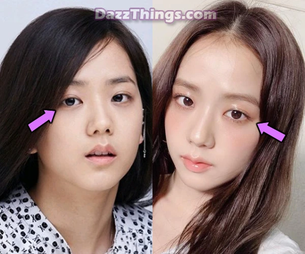 Blackpink Jisoo eyes before and after comparison photo