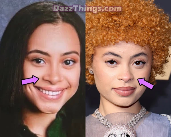 Ice Spice nose before and after photo comparison