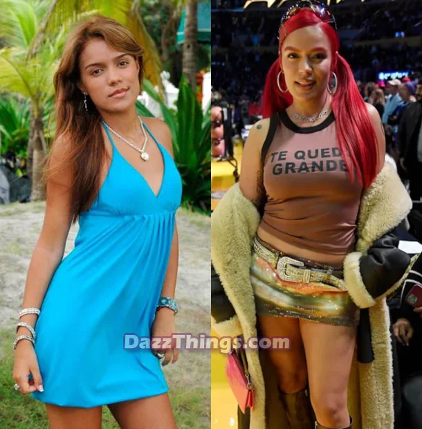 Karol G breast implants before and after comparison photo